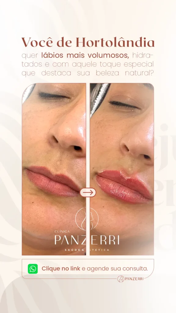 AnyConv.com__49. Dra Aline Panzerri